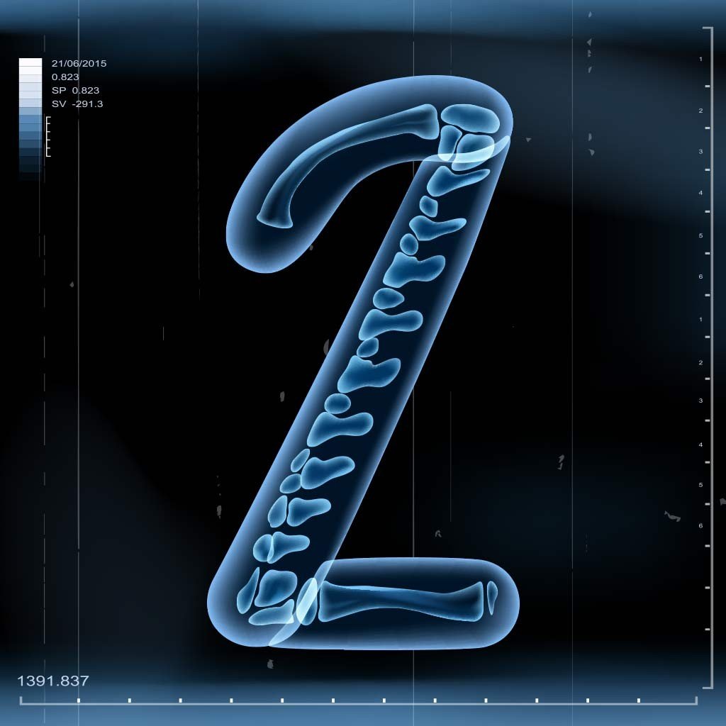 x-ray 2 x-ray 2