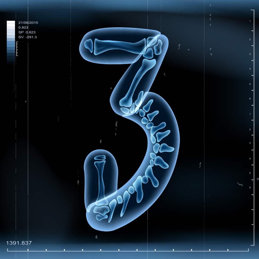 x-ray 3 x-ray 3