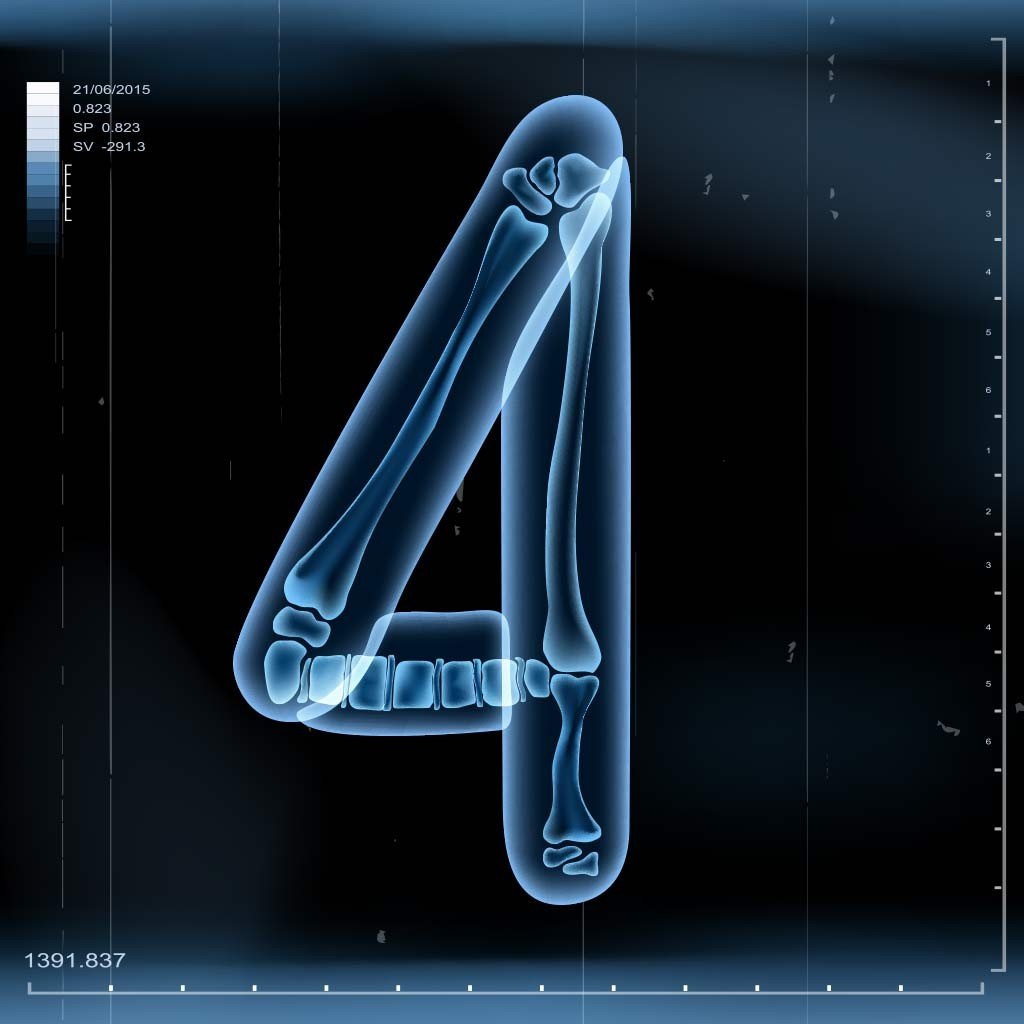 x-ray 4 x-ray 4