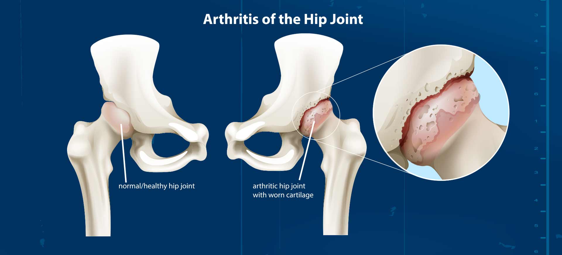 Dr_Richard_R_Grimsley_MD_Jacksonville_Orthopaedic_Institute Dr_Richard_R_Grimsley_MD_Jacksonville_Orthopaedic_Institute